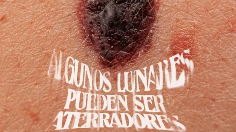 lunares